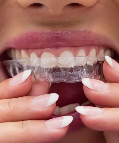 female-patient-wearing-braces-2